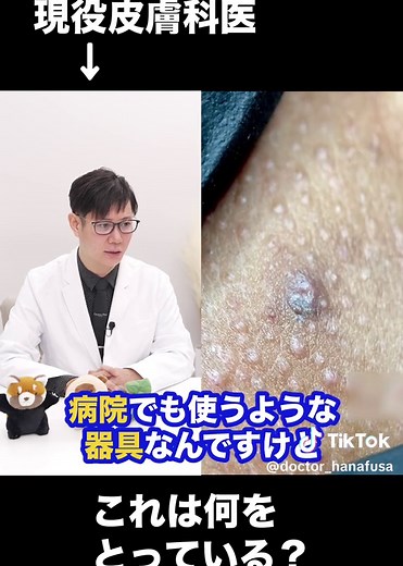 埋没毛の対処方法について解説！