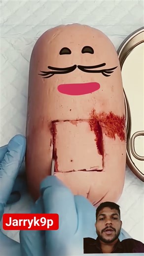 “Baby Surgery Simulation 😱👶”#shots #cartoon