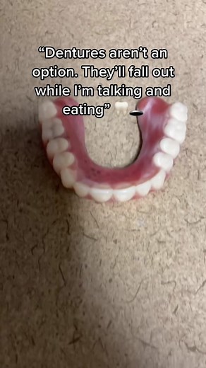 Implant Supported Dentures: Strong, Affordable, & Eat Like Normal