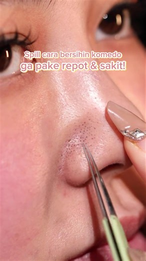 Atasi komedomu dengan Blackhead Removal Nose Patch dari Focalskin🛒 #focalskin #blackhead #focalskincare #nosepatch #komedo