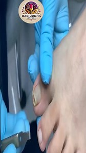 Trusted advice to support brittle toenails for active days 🤗🥹 #FootWellnessUSA #FootCareTips #HealthyHabits | Basiquinha