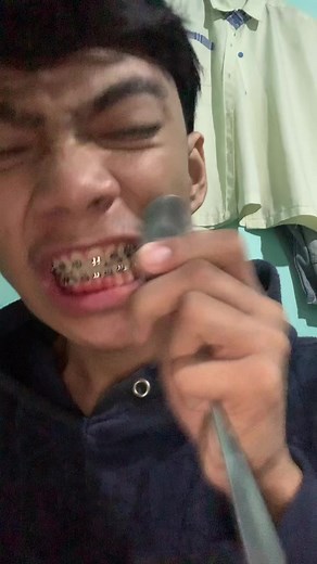 DIY Braces Removal: Step-by-Step Guide