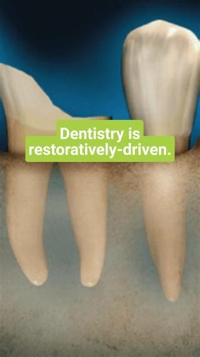 When a tooth cannot be restored, it doesn't matter whether endodontic treatment can be or is rendered. Long-term survival of that tooth cannot be predictably achieved. Treatment planning decisions need to focus on the restorability of the tooth when deciding what treatment will provide reasonable long-term success. If the tooth can be restored, then pursuing endodontic treatment is the best treatment decision. But when this cannot be accomplished, extraction and implant placement is the more pru