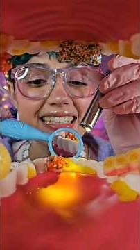 ASMR Tooth Fairy Eats Your Teeth Candy 🦷🍭🧚‍♀️ #asmr #asmrdentist #candyeating
