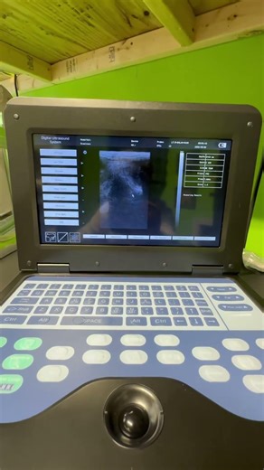 Ultrasound, Ball Python ￼🤘#baby #ultrasound #ballpython #egg #reptiles #pets #snake #shorts ￼