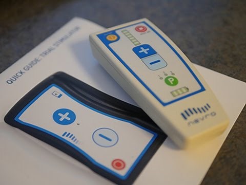 Nevro HF-10 Trial Video (REAL PATIENT)