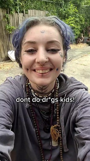 lees getting his dentures soon! #opiateaddictionawareness #🧊 #opiateepidemic #mentalillness #mentalillnessinnit #addicted #addict #addiction #recoveringaddict #addictionrecovery #addictionawareness #substanceabuseproblem #substanceabuseawareness #substanceusedisorder #substanceabuser #substanceabuse #substanceuse #fypシ #foru #harmreduction #harmreductionsaveslives #harmreductionworks #toothdecay