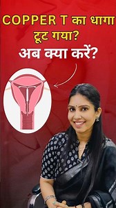 Copper T अंदर फंस जाए तो क्या करें? Impacted Copper T Removal Explained | Dr. Priya Meel