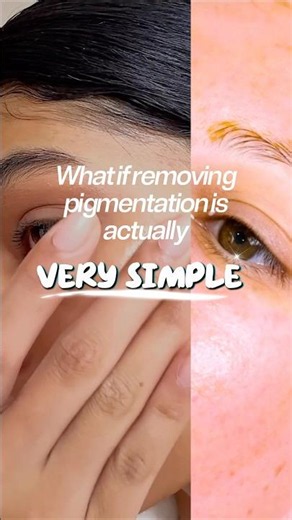 Post-treatment of removing pigmentation, supporting skin’s healing process is important.