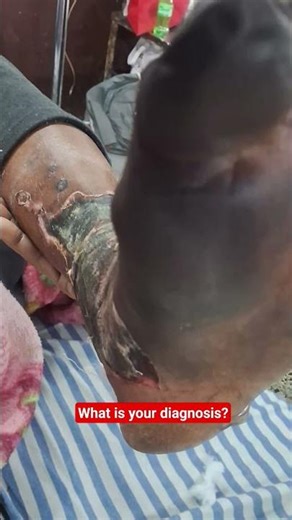 what is your diagnosis? #neet #motivation ‪@PrepLaddermedpg‬ ‪@drdclasses1‬ ‪@GuruVedanta‬