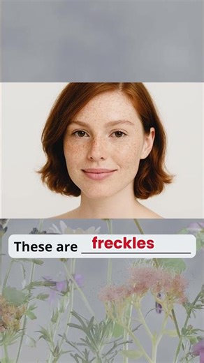 Skin Problems Vocabulary in English – Easy English Vocabulary for Beginners | Learn English Fast