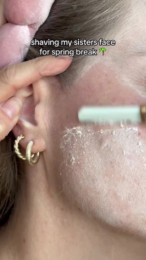 St Lucia Adventure 2024! Experience Smooth Skin and Glowing Beauty with Dermaplaning 🧳✨