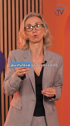 ✨ La doctora Raquel Rivera, dermatóloga, explica que el tratamiento de la psoriasis pustulosa generalizada (GPP) requiere muchas veces ingreso hospitalario. ✅ Lo positivo es que en la actualidad hay nuevos medicamentos, por lo que con un tratamiento precoz el tratamiento adecuado, se puede controlar esta enfermedad. 🎯A través del proyecto Derma TV, desde la Fundación Piel Sana de la AEDV te ofrecemos consejos generales para el cuidado y la prevención de enfermedades de tu piel. Ante cualquier d