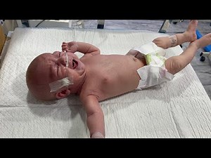 20 Days Old Baby with Excessive Crying & Continuous Fits | NICU Management & Care #babyrecovery