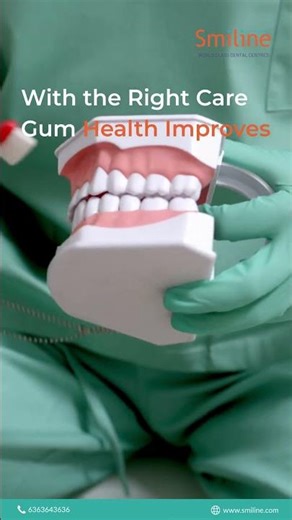 Bleeding Gums? Causes, Prevention & When to See a Dentist