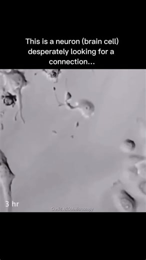 The tentacle-like projections branching from neurons are called dendrites, and their “connections” are synapses. This process, known as synaptogenesis, occurs when we learn new skills, experience something novel, or the brain rewires itself after an injury. | The Galactic Void