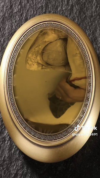 #jiggersremove #jiggers #remove #footcare #foryou