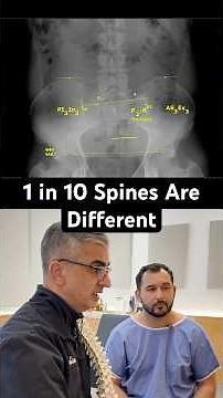1 in 10 People Have a Different Lower Back| Dr. Rahim Explaims