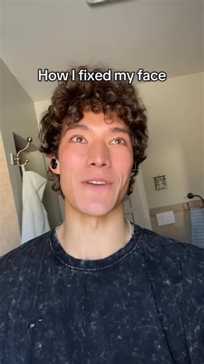 J A E L E N on Instagram: "Never publicly spoken about this, but I struggled with skin issued (acne and puffy face) most of 2023 and into 2024. The things that helped me were fixing my diet, exercise + sauna, simple skincare routine, mysterious, stress management, and lasers courtesy of @nurseinjector_lo_rn 🙏 if you’re struggling with acne or skin issues, I understand how hard that can be, it gets better #acne"