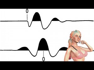 Continuous wavelet transform (CWT)