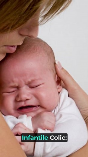 Infantile Colic: Understanding and Managing Infantile colic is a common yet perplexing condition affecting newborns. Characterized by excessive, inconsolable crying, often occurring in the late afternoon or evening, colic typically emerges around 2-3 weeks of age and often resolves by 3-4 months. The exact cause is unclear, but factors such as immature digestive systems, gas, and sensitivity to stimuli may contribute. Parents can take several steps to manage colic: Comfort Measures: Holding, swa