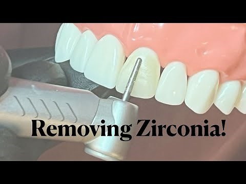 Zirconia 101: 11 of 11: Methods to remove zirconia