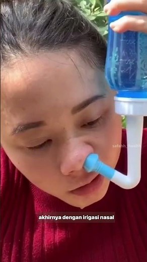 Chronic Sinusitis Cured with Nasal Irrigation #safahhhealth #sinusitis #sinusalirrigation