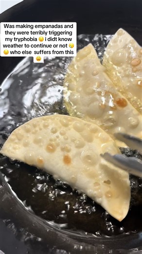 Empanadas and Trypophobia: A Baking Journey