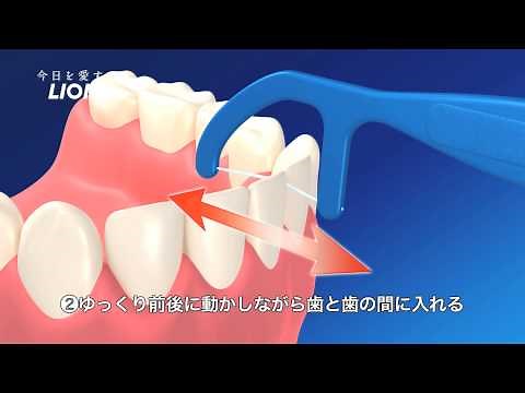 F字型デンタルフロスの使い方/Lidea（字幕付）
