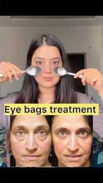 आंखों के नीचे की सूजन को कैसे हटाएं? #eyebags #skincare #ytshorts #viral