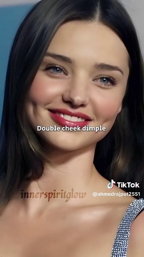 Different Types of Dimples Explained
