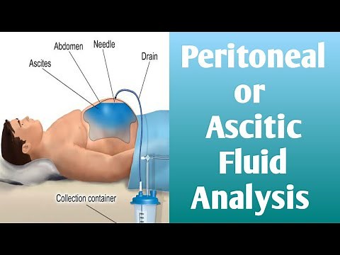 Peritoneal Fluid || Ascitic Fluid Analysis