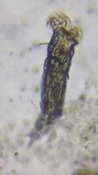Rotifer Feeding 🔬 | POCO + SVBONY