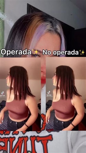 Operaciones estéticas: Mi experiencia personal