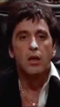 L’histoire de l’anesthésie et ses réticences