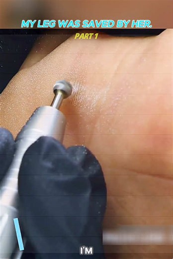 My leg was saved by her. P.1. #removal #relaxing #removal #clean #foryoupage