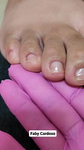 6M views · 99K reactions | unha transformada | Unhas | Facebook