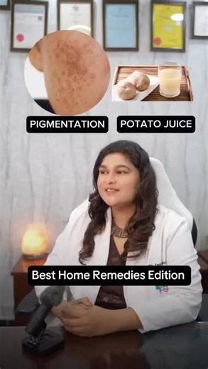 ✨ Clear Skin at Home 😳 Best DIY Remedies for Acne, Dull Skin & Dark Spots!