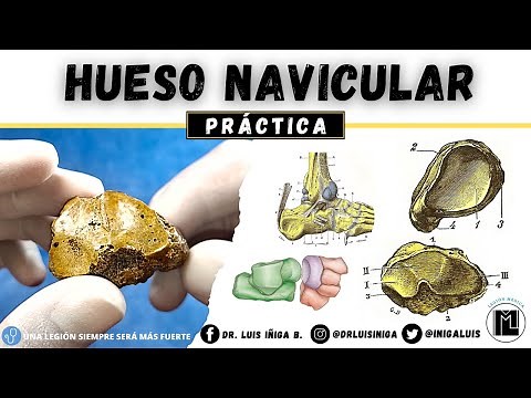 Practical Anatomy: Navicular or Scaphoid Bone | Surfaces, Borders, Joints, Ligaments