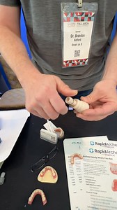Smart Denture Converions make it possible to use shorter TiBases when making a provisional prosthetic as part of a full arch fixed procedure. The shorter TiBases fit into the denture rather than going through it, making perfect occlusion possible with the provisional prosthetic. Check it out! @smartonx #fullarchdentistry #fagc2024 #progressivedental #fagc #implantdentistry | Implant Practice US
