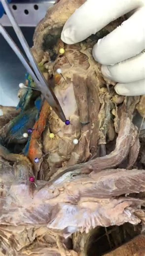 Human Anatomy Model: Chest Area Educational Demonstration