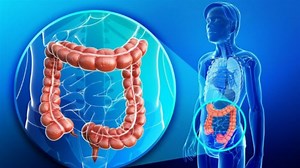 Cáncer de colon: Cómo prevenir esta patología a través estudios sencillos