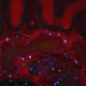 File:Uropathogenic-Escherichia-coli-P-and-Type-1-Fimbriae-Act-in-Synergy-in-a-Living-Host-to-Facilitate-ppat.1001298.s003.ogv - Wikimedia Commons