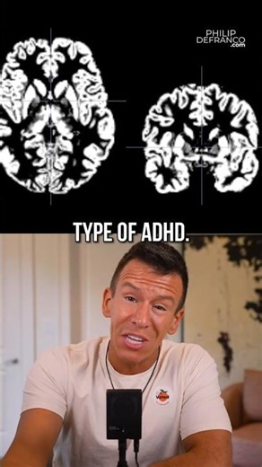 Brain Scans Reveal A Third Type Of ADHD