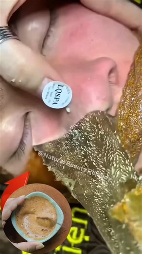 Remove Blackheads Permanently at Home ✨ Easy Blackheads & Whiteheads Removal Tips #blackheads