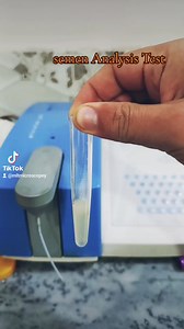 58K views · 1K reactions | Semen Analysis. | Wali Rehman Clinical Laboratory | Facebook