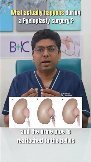 Pyeloplasty Surgery Explained Simply | Dr Kant Shah