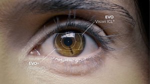 EVO Visian ICL - Conheça O Novo Implante Intraocular - Oftalmologia