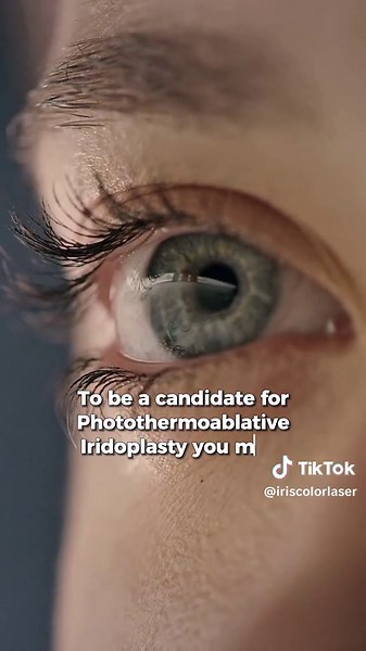 Candidatos para Cambio de Color de Ojos con Láser