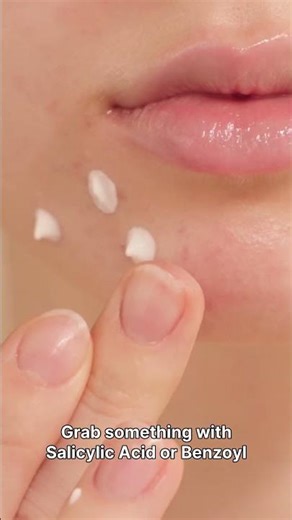 how to get rid of pimples #acnetreatment #pimpleremedy ##pimpleemergency #skincareroutine